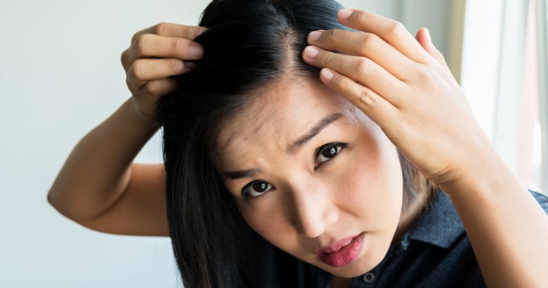 40% mẹ bầu gặp phải tính trạng rung tóc sau khi sinh. (Ảnh: Sưu tầm Internet)