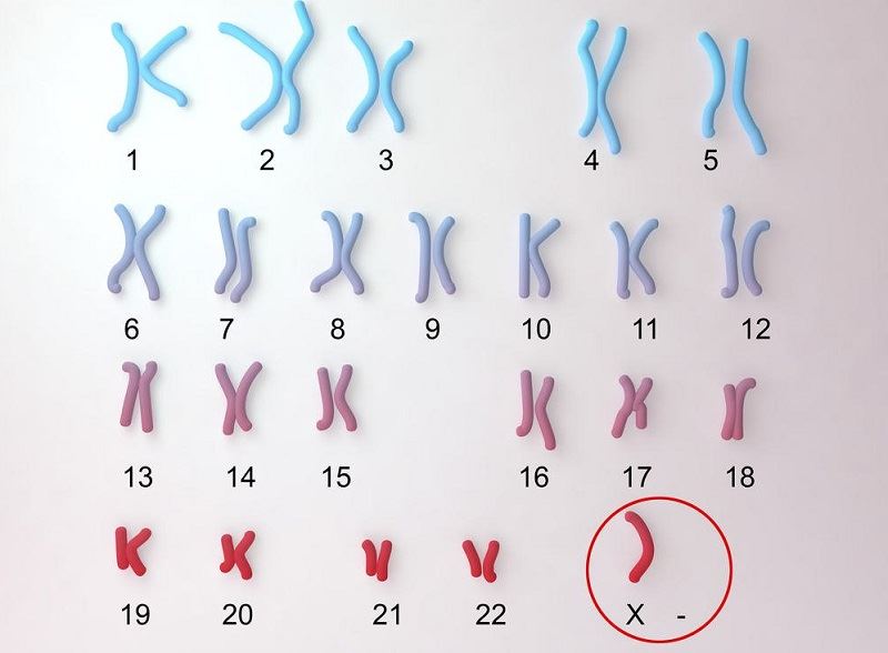 Xét nghiệm sàng lọc bất thường nhiễm sắc thể. (Ảnh: Internet)