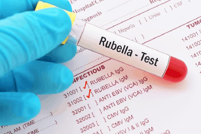 Xét nghiệm sàng lọc virus Rubella. (Ảnh: Internet)