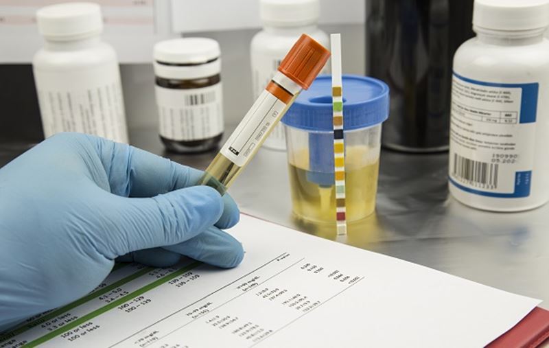 Xét nghiệm phân tích, đánh giá nước tiểu. (Ảnh: Internet)