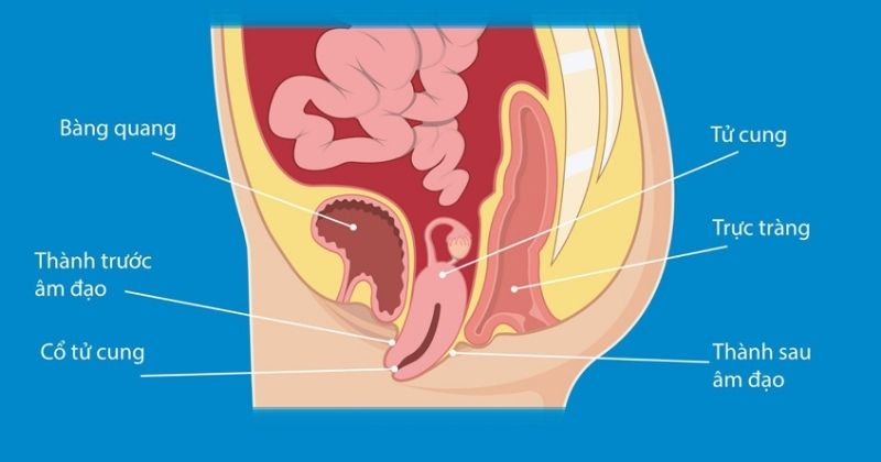 Sa tạng vùng chậu gây ra hiện tượng Queefing (Ảnh: Sưu tầm Internet)