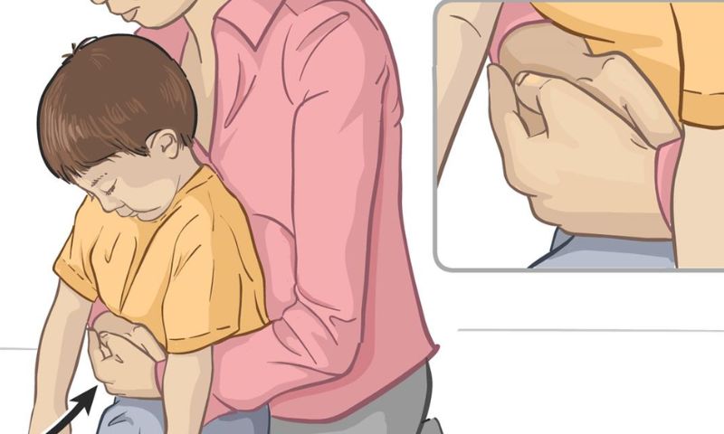 Phương pháp Heimlich chữa hóc sặc cho trẻ. (Ảnh: Nguồn Internet)