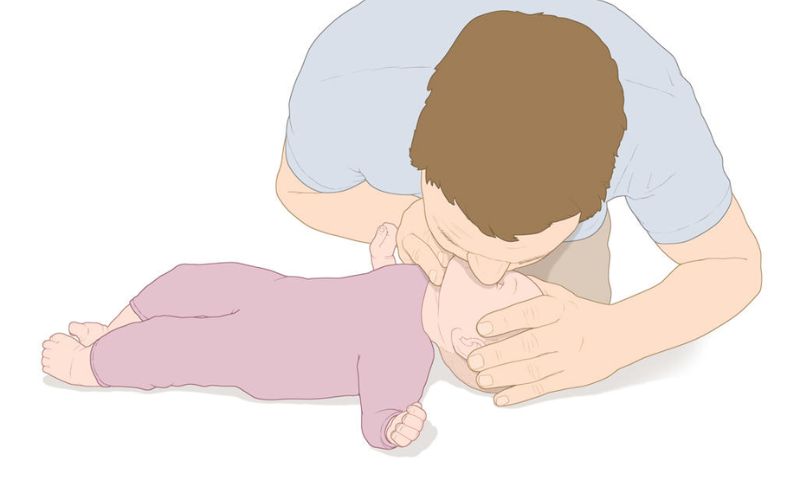 Ép tim thổi ngạt cho trẻ trong trường hợp trẻ ngừng thở. (Ảnh: Nguồn Internet)
