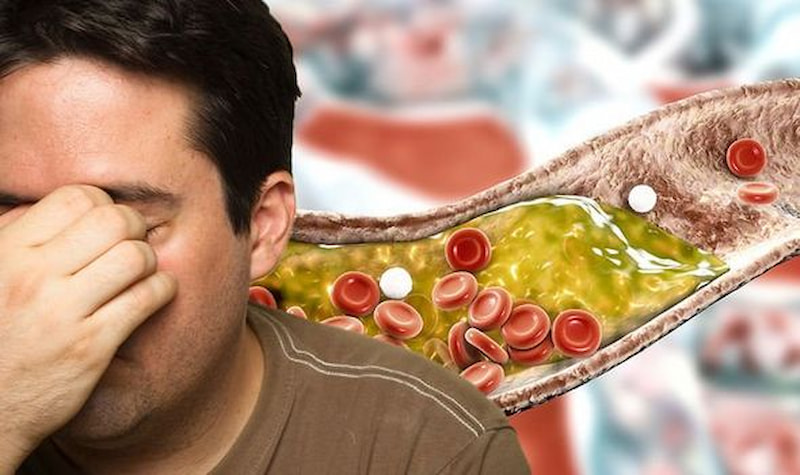 Bạn nên kiểm soát lượng cholesterol nạp vào cơ thể dưới 200mg mỗi ngày.  (Ảnh: Sưu tầm Internet)