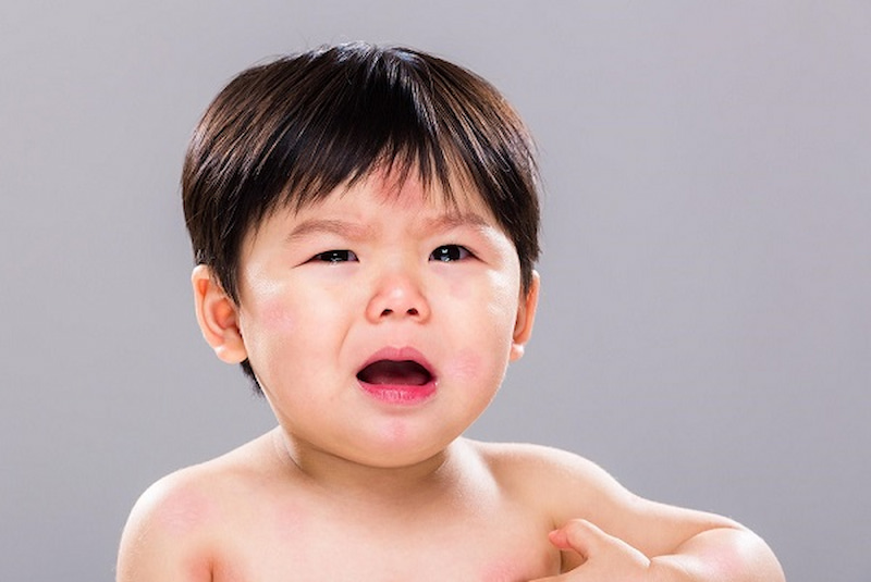 Nguyên tắc xây dựng thực đơn ăn dặm cho bé dị ứng sữa. (Ảnh: Sưu tầm Internet)