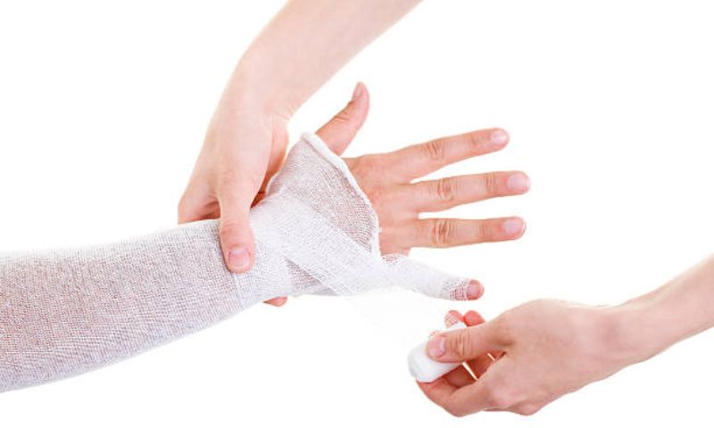 Hướng dẫn chăm sóc vết bỏng khi trẻ bị bỏng tại nhà (Nguồn: Sưu tầm Internet)