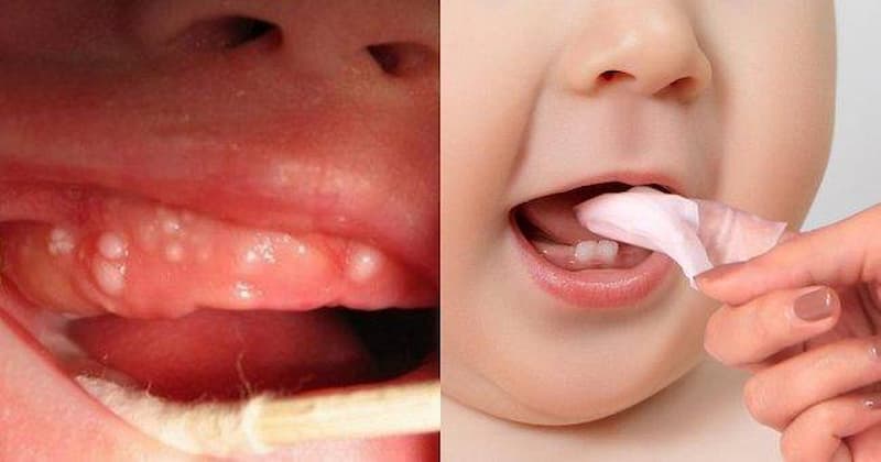 Đảm bảo vệ sinh răng miệng cho con sạch sẽ. (Ảnh: sưu tầm internet)