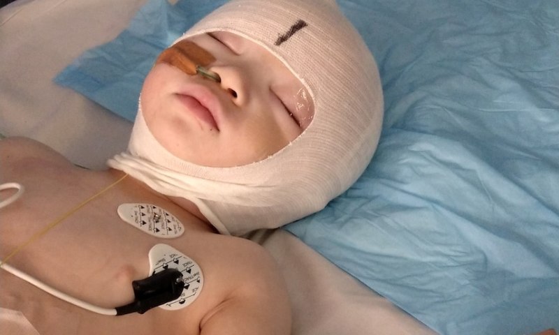 Những chấn thương trung bình đến nặng bố mẹ cần làm gì? (Nguồn: Sưu tầm internet)