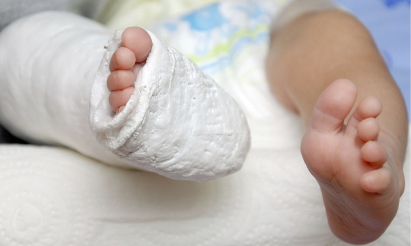 Kiểm tra những chấn thương sau khi trẻ 5 tháng bị ngã từ giường xuống (Nguồn: Sưu tầm Internet)