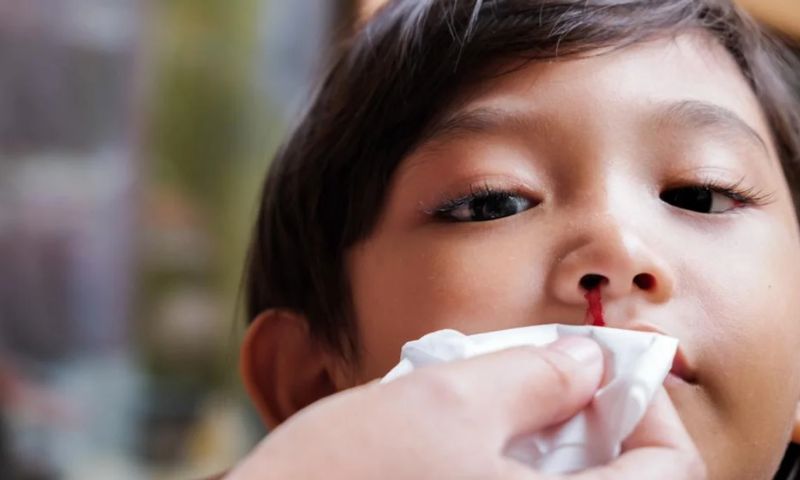 Trẻ 6 tuổi bị chảy máu cam có nguy hiểm hay không? (Ảnh: Nguồn Internet)