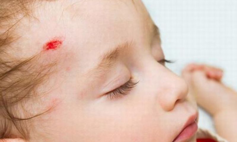 Trẻ bị ngã đập đầu có bị ảnh hưởng đến não không? (Ảnh: Nguồn Internet)