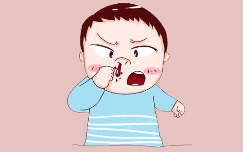 Chảy máu cam và thông tin về chảy máu mũi ở trẻ (Nguồn: Sưu tầm Internet)