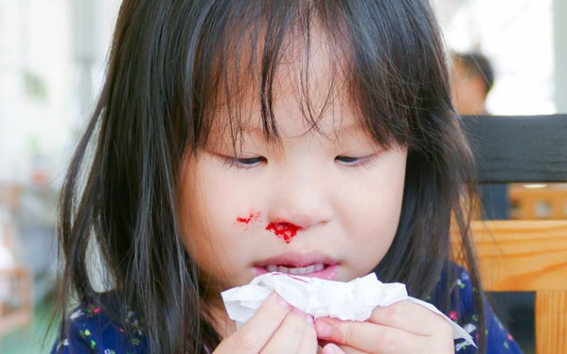 Nguyên nhân hiếm gặp trẻ bị chảy máu cam có nguy hiểm không? (Nguồn: Sưu tầm Internet)