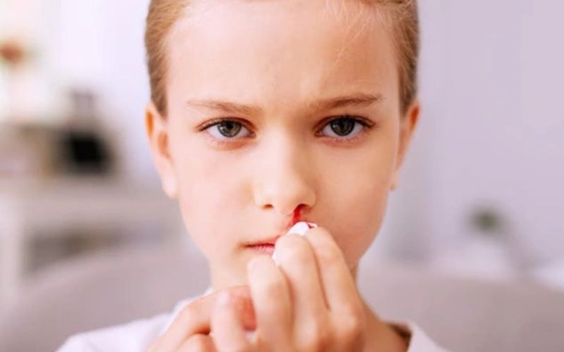 Trẻ bị chảy máu cam có nguy hiểm không? Khi nào cần đưa bé đến bệnh viện (Nguồn: Sưu tầm Internet)