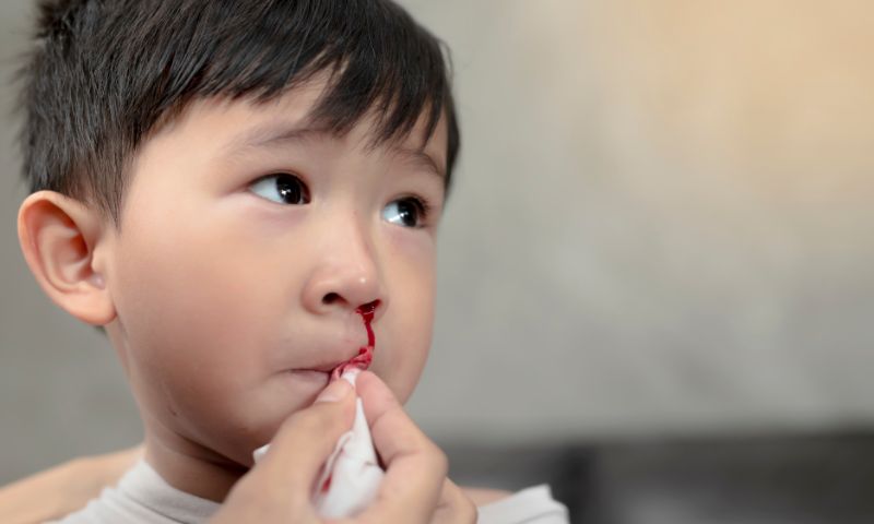 Hướng dẫn cách cầm máu khi trẻ bị chảy máu cam. (Ảnh: Nguồn Internet)