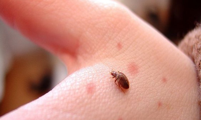 Rệp cắn trẻ em sẽ xuất hiện những biểu hiện như thế nào? Có nguy hiểm hay không? (Nguồn: Sưu tầm Internet)