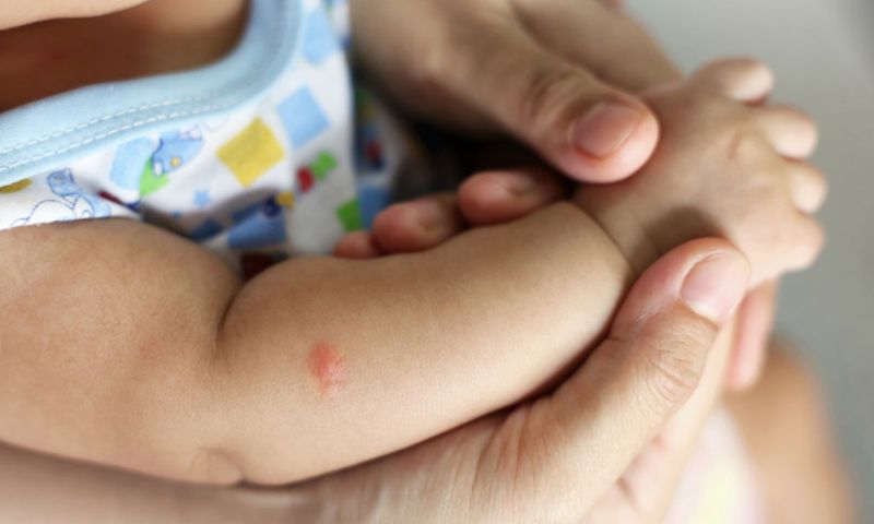 Trẻ nhỏ bị kiến đốt sưng tay. (Ảnh: Nguồn Internet)
