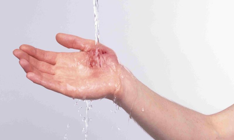 Vệ sinh vết thương khi trẻ bị đứt tay - Trẻ bị đứt tay phải làm sao? (Nguồn: Sưu tầm Internet)