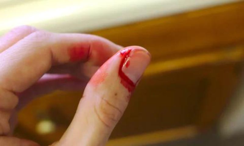 Nên sử dụng thuốc giảm đau theo hướng dẫn của bác sĩ khi trẻ bị đứt tay (Nguồn: Sưu tầm Internet)