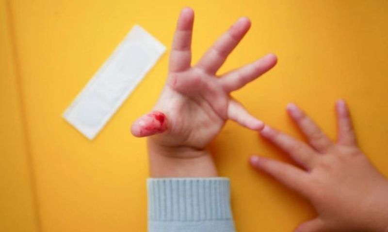 Sơ cứu ban đầu khi trẻ bị đứt tay sâu - bé bị đứt tay sâu phải làm sao (Nguồn: Sưu tầm Internet)