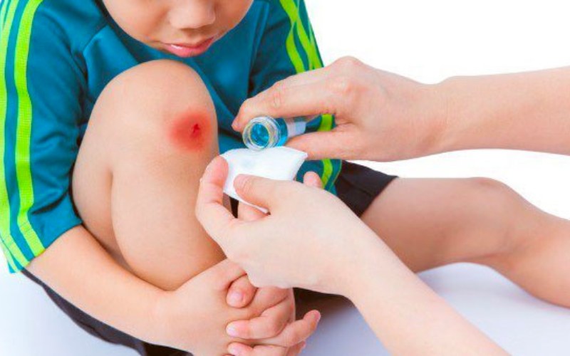 Đối với những vết thương ngoài da, bố mẹ có thể tự sơ cứu ở nhà cho bé (Ảnh: Sưu tầm internet)