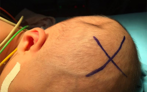 Đầu bé bị bóp méo do tai nạn, cần đưa đến bệnh viện ngay (Ảnh: Sưu tầm trên Internet)