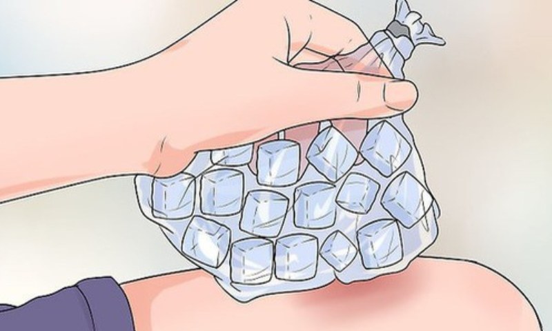 Chườm đá lạnh giúp giảm đau cho trẻ. (Ảnh: Nguồn Internet)