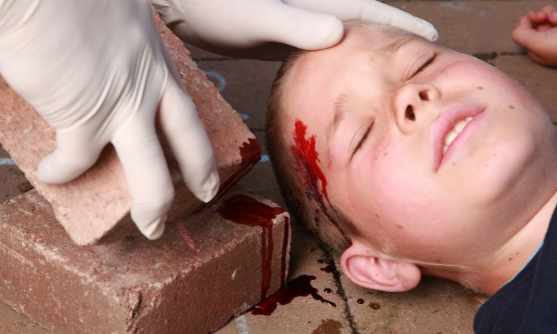 Trẻ bị ngã đập đầu phía trước chảy nhiều máu. (Ảnh: Nguồn Internet)