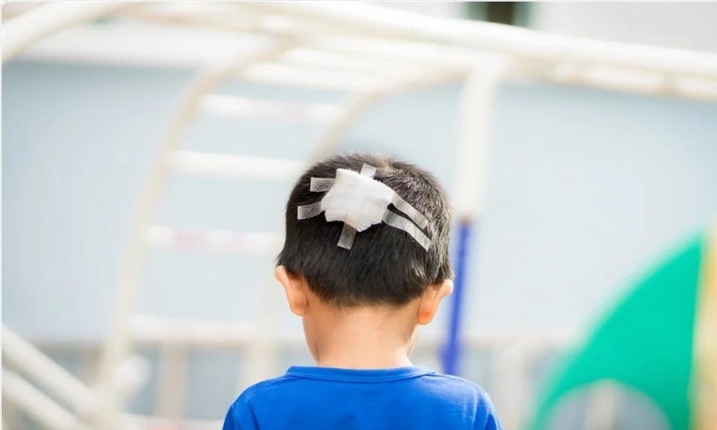 Hướng dẫn xử lý khi trẻ bị ngã chấn thương sọ não (Nguồn: Sưu tầm Internet)