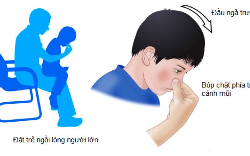 Hướng dẫn cách cầm máu dành cho trẻ mà bố mẹ cần biết (Ảnh: Sưu tầm Internet)