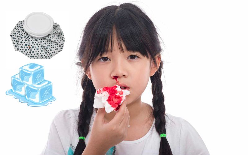 Chườm lạnh vào phần mũi của bé để giảm đau và để máu ngưng chảy (Ảnh: Sưu tầm Internet)