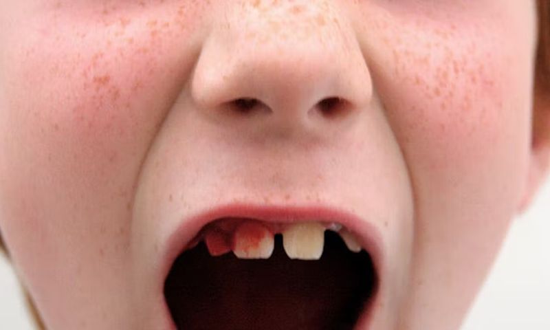 Khi nào cần đưa trẻ đến bệnh viện. (Ảnh: Nguồn Internet)