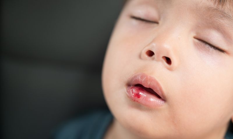 Bé bị lơ mơ, tỉnh táo. (Ảnh: Nguồn Internet)