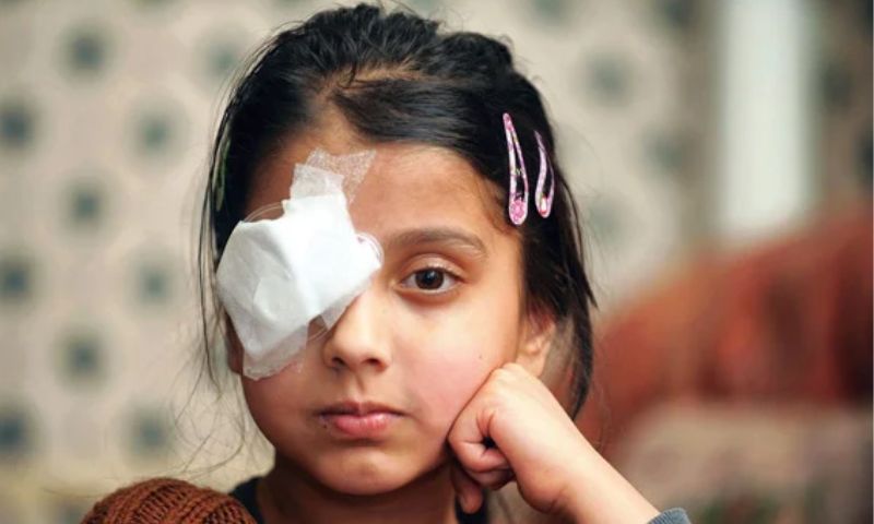 Bảo vệ trẻ khỏi những nguy cơ gây té ngã sưng mắt - Những biện pháp phòng tránh (Nguồn: Sưu tầm Internet)