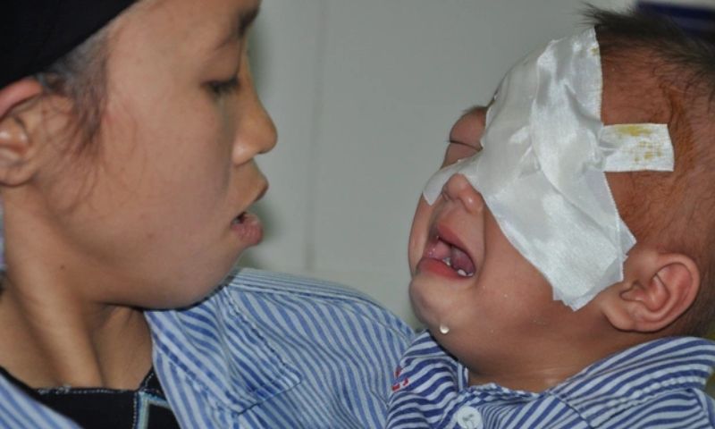 Những loại chấn thương mắt có thể có khi trẻ bị ngã (Nguồn: Sưu tầm Internet)