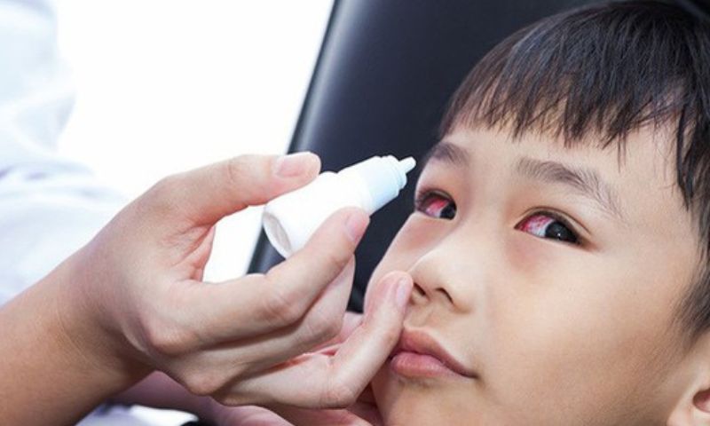 Trẻ bị ngã sưng mắt phải làm sao? Sử dụng nước muối xử lý khi bị sưng mắt (Nguồn: Sưu tầm Internet)