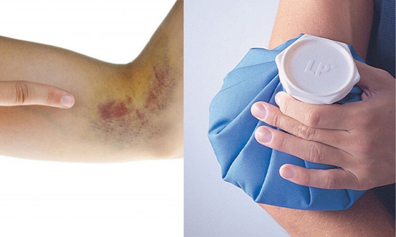 Trẻ bị trật khớp sau khi bị ngã có những biện pháp xử lý như thế nào? (Nguồn: Sưu tầm Internet)