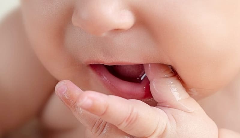 Hậu quả của việc trẻ chậm mọc răng. (Ảnh: sưu tầm internet)