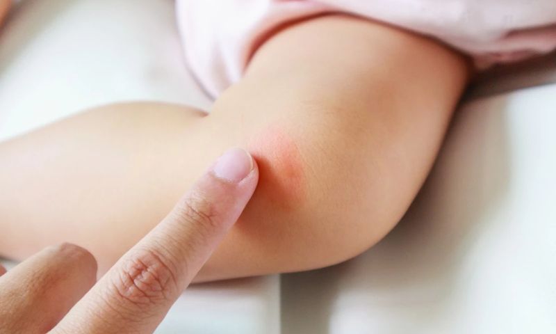 Xử lý đúng cách sẽ giúp bé hạn chế được nguy cơ tăng nặng. (Ảnh: Nguồn Internet)