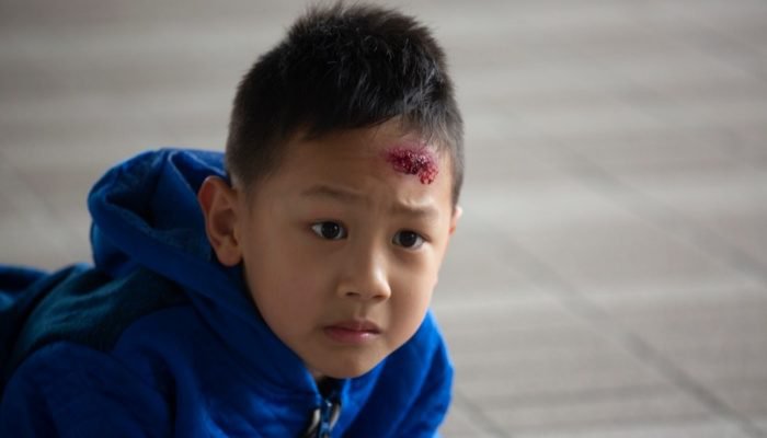 Những dấu hiệu nguy hiểm khi trẻ bị ngã ngay lập tức (Nguồn: Sưu tầm Internet)