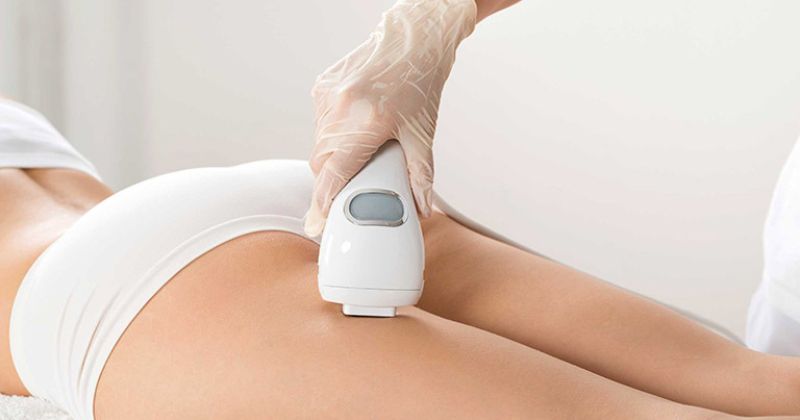 Trị rạn da bằng tia Laser là phương pháp sử dụng công nghệ tiên tiến
