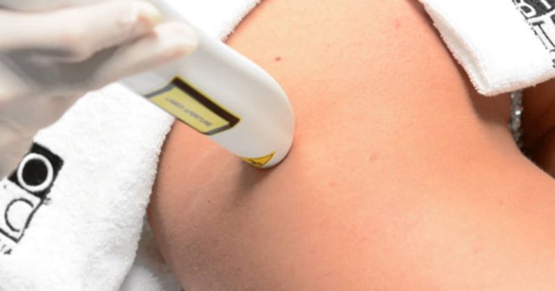 Ưu điểm của phương pháp trị rạn da bằng tia laser (Ảnh: Sưu tầm Internet)