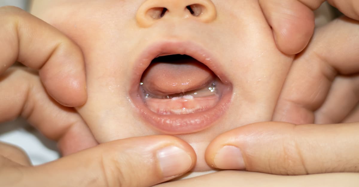 Trẻ mọc răng có nôn không? Khi nào cần đến bác sĩ?