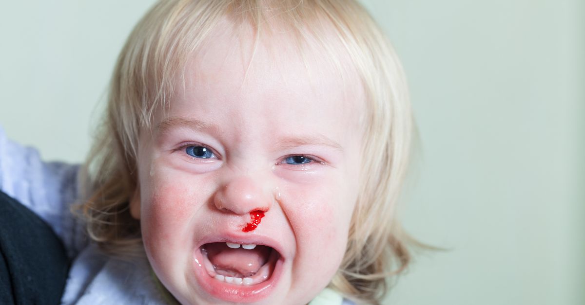 Trẻ 1 tuổi bị chảy máu cam có nguy hiểm hay không?