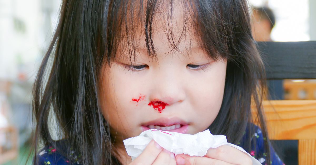 Trẻ 5 tuổi bị chảy máu cam có đang gặp nguy hiểm?