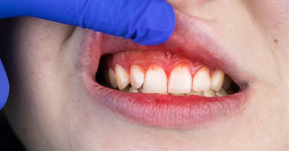 [Chuyên gia giải đáp] Trẻ mấy tháng mọc răng: thứ tự, dấu hiệu, cách chăm sóc