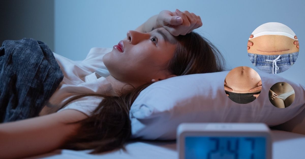 Phụ nữ bị mất ngủ sau sinh mổ có nguy hiểm không? 3+ Cách khắc tốt nhất